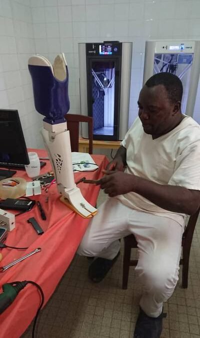 CAMERÚN – Douala – Prótesis que cambian vidas